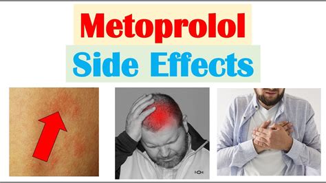 metoprolol beta blocker|Metoprolol Side Effects: Common, Severe, Long Term .